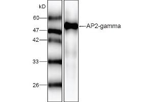 Western blot analysis of recombinant AP2 gamma, using AP2 gamma antibody (1/1000 dilution). (TFAP2C Antikörper)