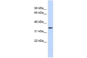 WB Suggested Anti-OR13C5 Antibody Titration:  0. (OR13C5 Antikörper  (N-Term))