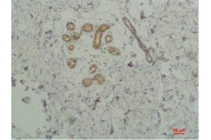 Immunohistochemistry (IHC) analysis of paraffin-embedded Human SkinTissue using STAT2 Rabbit Polyclonal Antibody diluted at 1:200. (STAT2 Antikörper)