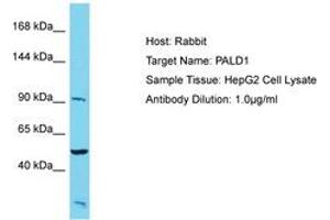 Image no. 1 for anti-Phosphatase Domain Containing, Paladin 1 (PALD1) (AA 143-192) antibody (ABIN6750572) (KIAA1274 Antikörper  (AA 143-192))