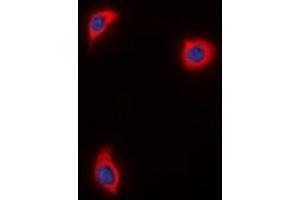 Immunofluorescent analysis of AKAP1 staining in HuvEc  cells. (AKAP1 Antikörper)