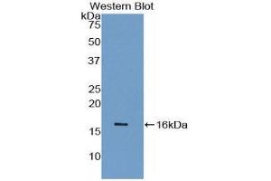 Western Blotting (WB) image for anti-Synuclein, gamma (Breast Cancer-Specific Protein 1) (SNCG) (AA 1-115) antibody (ABIN1078560) (SNCG Antikörper  (AA 1-115))