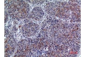 Immunohistochemistry (IHC) analysis of paraffin-embedded Human Lung, antibody was diluted at 1:100. (LILRA1 Antikörper  (N-Term))