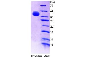 SDS-PAGE analysis of Human GBP4 Protein. (GBP4 Protein)