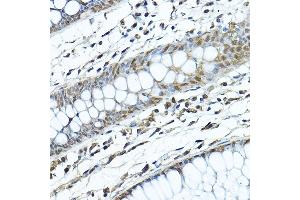 Immunohistochemistry of paraffin-embedded human colon using [KO Validated] SIRT1 Rabbit pAb (ABIN6129328, ABIN6147784, ABIN6147785 and ABIN6215138) at dilution of 1:200 (40x lens). (SIRT1 Antikörper  (AA 448-747))