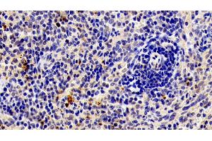 Detection of MMP9 in Rabbit Spleen Tissue using Polyclonal Antibody to Matrix Metalloproteinase 9 (MMP9)
