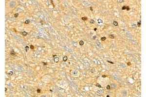 ABIN6259156 and ABIN6275313 at 1/100 staining Rat brain tissue by IHC-P. (PPP1R8 Antikörper  (Internal Region))