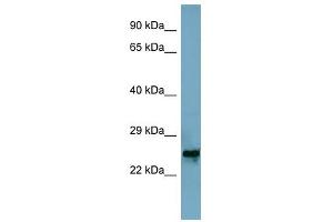 MRPL48 antibody used at 1 ug/ml to detect target protein. (MRPL48 Antikörper  (Middle Region))