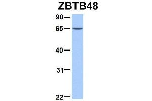 Host:  Rabbit  Target Name:  ZBTB48  Sample Type:  293T  Antibody Dilution:  1.