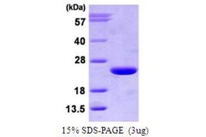SDS-PAGE (SDS) image for ADP-Ribosylation Factor 3 (ARF3) (AA 1-181) protein (His tag) (ABIN666643) (ARF3 Protein (AA 1-181) (His tag))