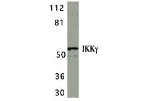Western Blotting (WB) image for anti-Inhibitor of kappa Light Polypeptide Gene Enhancer in B-Cells, Kinase gamma (IKBKG) (C-Term) antibody (ABIN1030433) (IKBKG Antikörper  (C-Term))