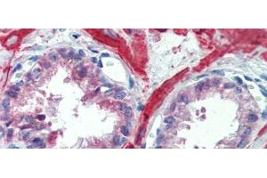 Immunohistochemistry (IHC) image for anti-Insulin-Like Growth Factor Binding Protein 4 (IGFBP4) (Middle Region) antibody (ABIN2782316)