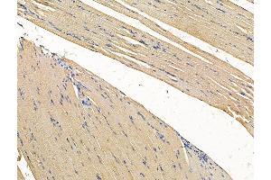 ABIN7096273 and ABIN7100335 at 1/100 staining rat muscle tissue by IHC-P. (VWA5B2 Antikörper)