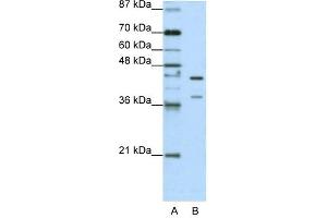 HNRPK antibody used at 1. (HNRNPK Antikörper  (C-Term))