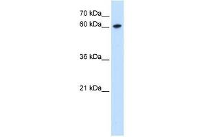 Western Blot showing ZNF169 antibody used at a concentration of 0. (ZNF169 Antikörper  (Middle Region))