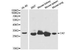 Western blot analysis of extracts of various cell lines, using CA2 antibody. (CA2 Antikörper  (AA 1-250))