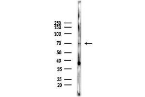 anti-Coiled-Coil Domain Containing 22 (CCDC22) (C-Term) antibody