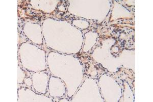 Figure. (Caspase 3 Antikörper  (AA 29-175))