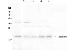 Western blot analysis of BAFF Receptor using anti-BAFF Receptor antibody . (TNFRSF13C Antikörper  (AA 1-78))