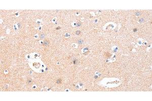Immunohistochemistry of paraffin-embedded Human brain using B3GAT1 Polyclonal Antibody at dilution of 1:40 (CD57 Antikörper)