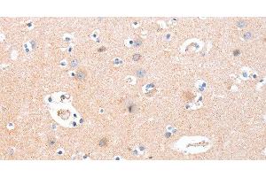 Immunohistochemistry of paraffin-embedded Human brain using B3GAT1 Polyclonal Antibody at dilution of 1:40 (CD57 Antikörper)