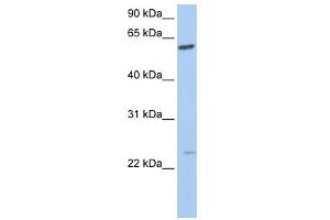 WB Suggested Anti-FAM3C Antibody Titration:  0. (FAM3C Antikörper  (C-Term))