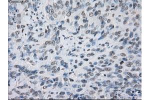 Immunohistochemical staining of paraffin-embedded colon tissue using anti-KDM4C mouse monoclonal antibody. (KDM4C Antikörper)
