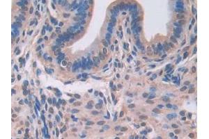 DAB staining on IHC-P; Samples: Mouse Uterus Tissue (LGALS3BP Antikörper  (AA 19-577))