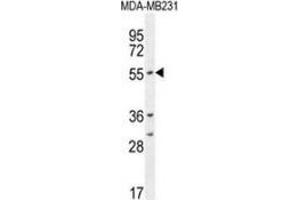Western blot analysis in MDA-MB231 cell line lysates (35ug/lane) using CYP2A7  Antibody . (CYP2A7 Antikörper  (Middle Region))