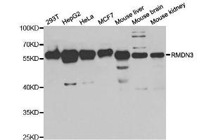 Western blot analysis of extracts of various cell lines, using RMDN3 antibody. (RMDN3 Antikörper  (AA 171-470))