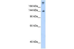 SF3B1 antibody used at 1. (SF3B1 Antikörper  (N-Term))