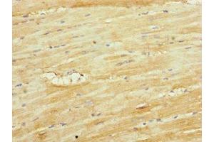 Immunohistochemistry (IHC) image for anti-Ubiquinol-Cytochrome C Reductase Core Protein I (UQCRC1) (AA 1-63) antibody (ABIN7149113)
