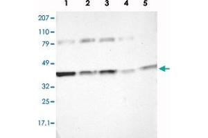 Western blot analysis of Lane 1: RT-4, Lane 2: EFO-21, Lane 3: A-431, Lane 4: Liver, Lane 5: Tonsil with IDH3G polyclonal antibody  at 1:250-1:500 dilution. (IDH3G Antikörper)