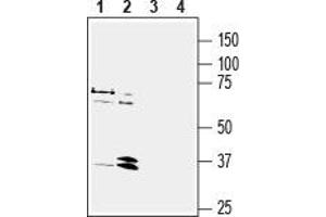 Western blot analysis of human  breast adenocarcinoma cell line lysate (lanes 1 and 3) and human  promyelocytic leukemia cell line lysate (lanes 2 and 4):1, 2. (Neuropeptide Y Receptor Y1 (NPY1R) Peptid)