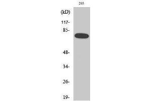 Western Blotting (WB) image for anti-Nuclear Factor-kB p65 (NFkBP65) (pSer468) antibody (ABIN3172939) (NF-kB p65 Antikörper  (pSer468))