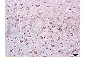 Formalin-fixed and paraffin embedded rat brain tissue labeled Anti-PEGF Polyclonal Antibody, Unconjugated (ABIN672456) at 1:200, followed by conjugation to the secondary antibody and DAB staining