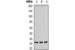 Western blot analysis of CD300f expression in A431 (A), Jurkat (B), PC12 (C) whole cell lysates. (IREM1 Antikörper)