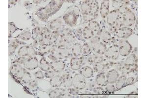 Image no. 1 for anti-Slingshot Homolog 3 (SSH3) (AA 293-392) antibody (ABIN599261) (SSH3 Antikörper  (AA 293-392))