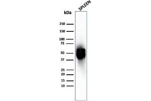 Western Blot Analysis of human spleen tissue lysate using Thymidine Phosphorylase Rabbit Recombinant Monoclonal (TYMP/2890R). (Rekombinanter Thymidine Phosphorylase Antikörper)