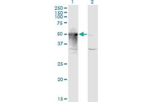 Western Blot analysis of ARMC6 expression in transfected 293T cell line by ARMC6 monoclonal antibody (M03), clone 2H8. (ARMC6 Antikörper  (AA 1-476))