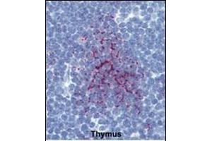 Formalin-fixed and paraffin-embedded human Thymus tissue reacted with SENP1 Antibody (N-term) (ABIN388042 and ABIN2845560) , which was peroxidase-conjugated to the secondary antibody, followed by AEC staining. (SENP1 Antikörper  (N-Term))