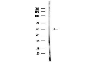 anti-Pleiomorphic Adenoma Gene-Like 1 (PLAGL1) (Internal Region) antibody