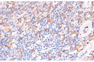 Immunohistochemistry of paraffin-embedded Human tonsil using CYBA Polyclonal Antibody at dilution of 1:100 (40x lens). (CYBA Antikörper)
