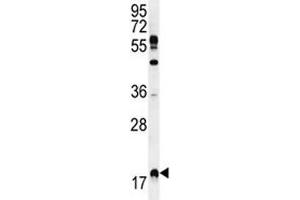 RHEB antibody western blot analysis in MDA-MB231 lysate.