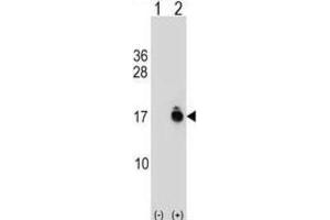 Western Blotting (WB) image for anti-Acylphosphatase 1, Erythrocyte (Common) Type (Acyp1) antibody (ABIN2999420) (ACYP1 Antikörper)