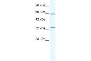 WB Suggested Anti-ZBTB7A Antibody Titration:  1. (ZBTB7A Antikörper  (Middle Region))