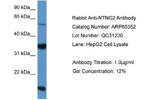 WB Suggested Anti-NTNG2  Antibody Titration: 0. (Netrin G2 Antikörper  (Middle Region))