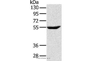Western blot analysis of Raji cell, using CYTH1 Polyclonal Antibody at dilution of 1:200