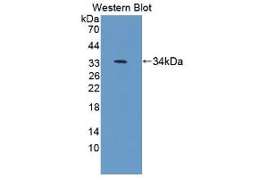 Western blot analysis of the recombinant protein. (Antizyme Inhibitor 1 Antikörper  (AA 1-280))