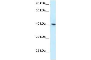 Western Blot showing RBMX antibody used at a concentration of 1 ug/ml against OVCAR-3 Cell Lysate (RBMX Antikörper  (C-Term))